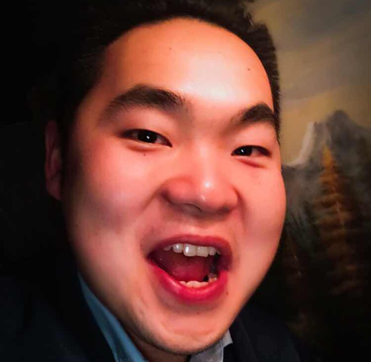 黑嘴